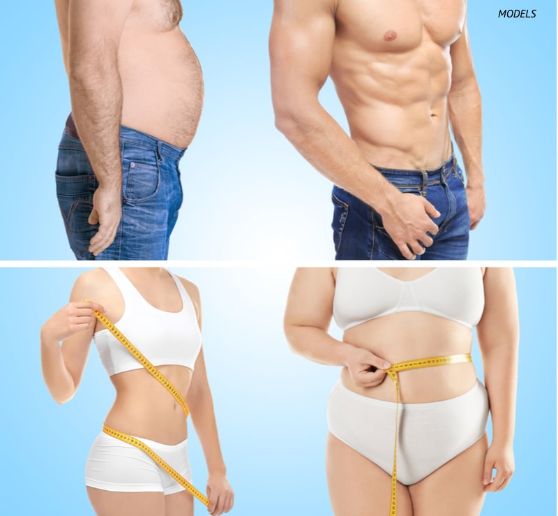 Man and woman before and after liposuction/weight loss concept.