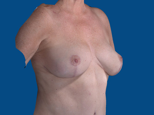 After Image