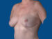 After Image