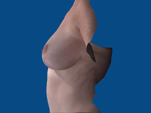 After Image