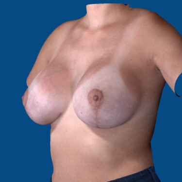 After Image
