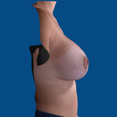After Image