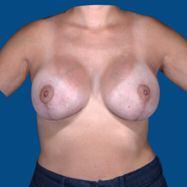 After Image