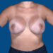 After Image
