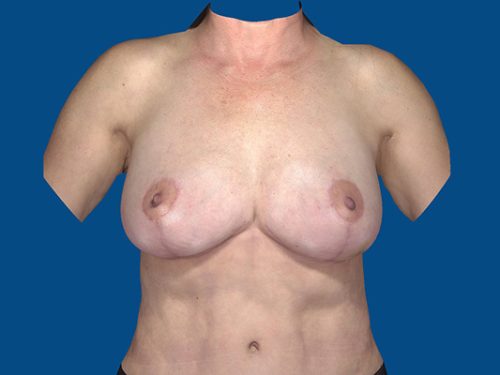 After Image