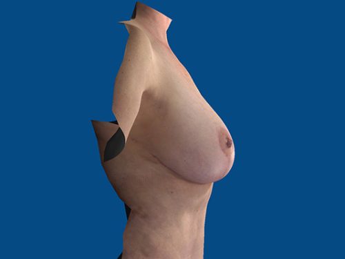 After Image