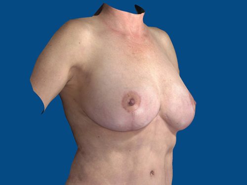 After Image