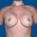 After Image