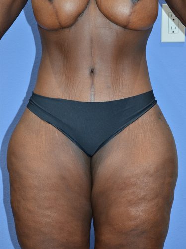 After Image