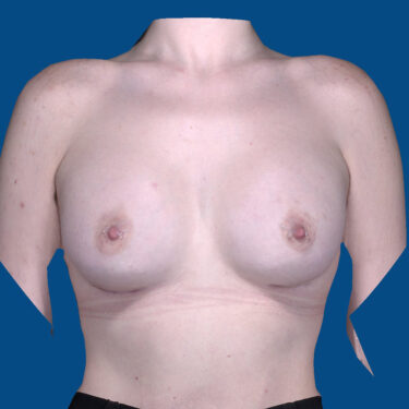 After Image