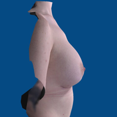 After Image