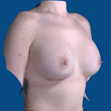 After Image