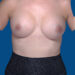 After Image