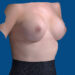 After Image