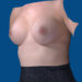 After Image