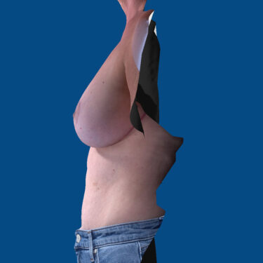 After Image