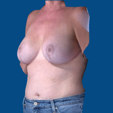 After Image
