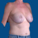 After Image