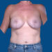 After Image