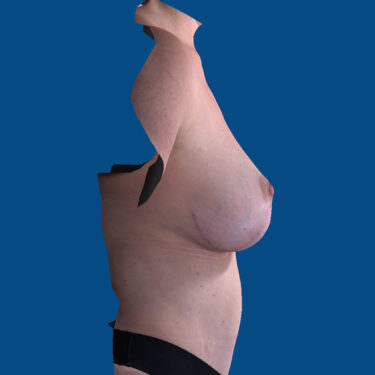 After Image