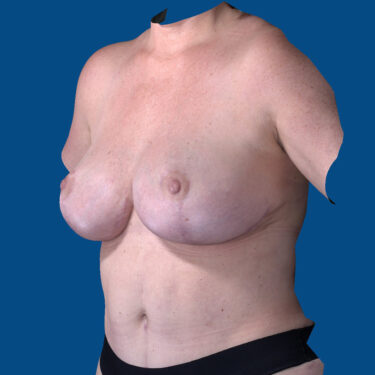 After Image