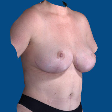After Image
