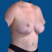 After Image