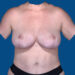 After Image