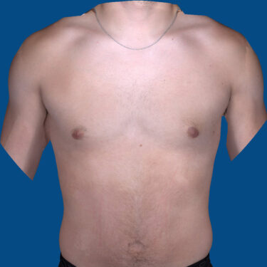 After Image