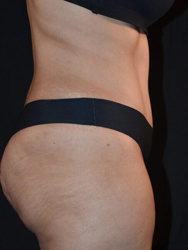 After Image