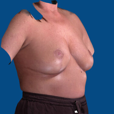 After Image