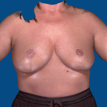 After Image