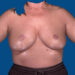 After Image