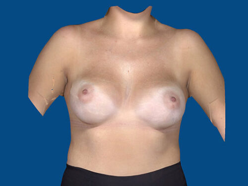 After Image