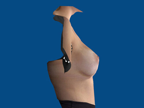 After Image