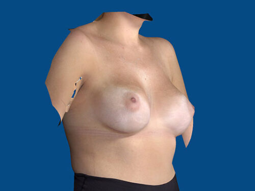 After Image