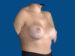 After Image