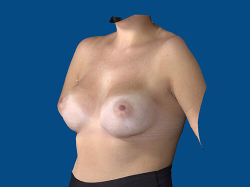 After Image