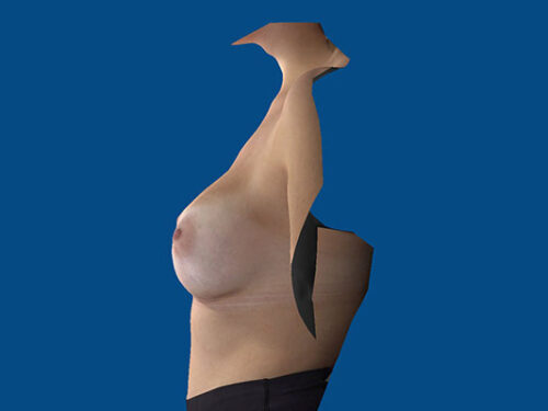 After Image