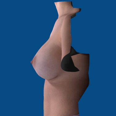 After Image