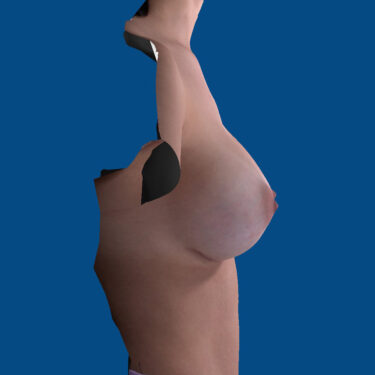After Image
