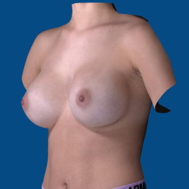 After Image