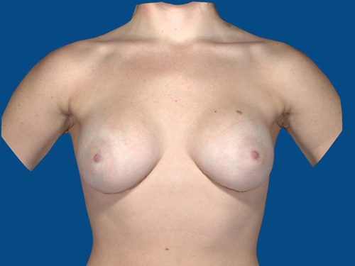 After Image