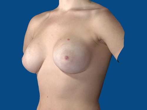 After Image