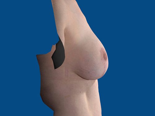 After Image