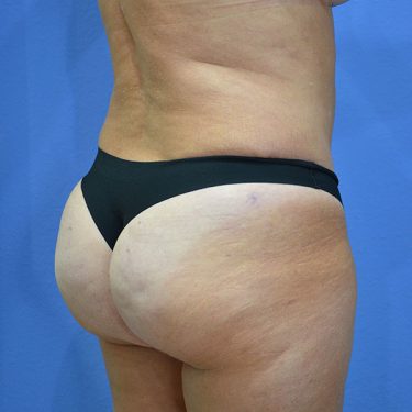 After Image