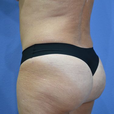 After Image
