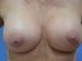 After Image
