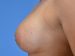 After Image