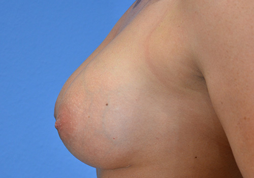 After Image